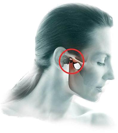 Disfunção Temporomandibular (DTM): causas, sintomas e tratamento
