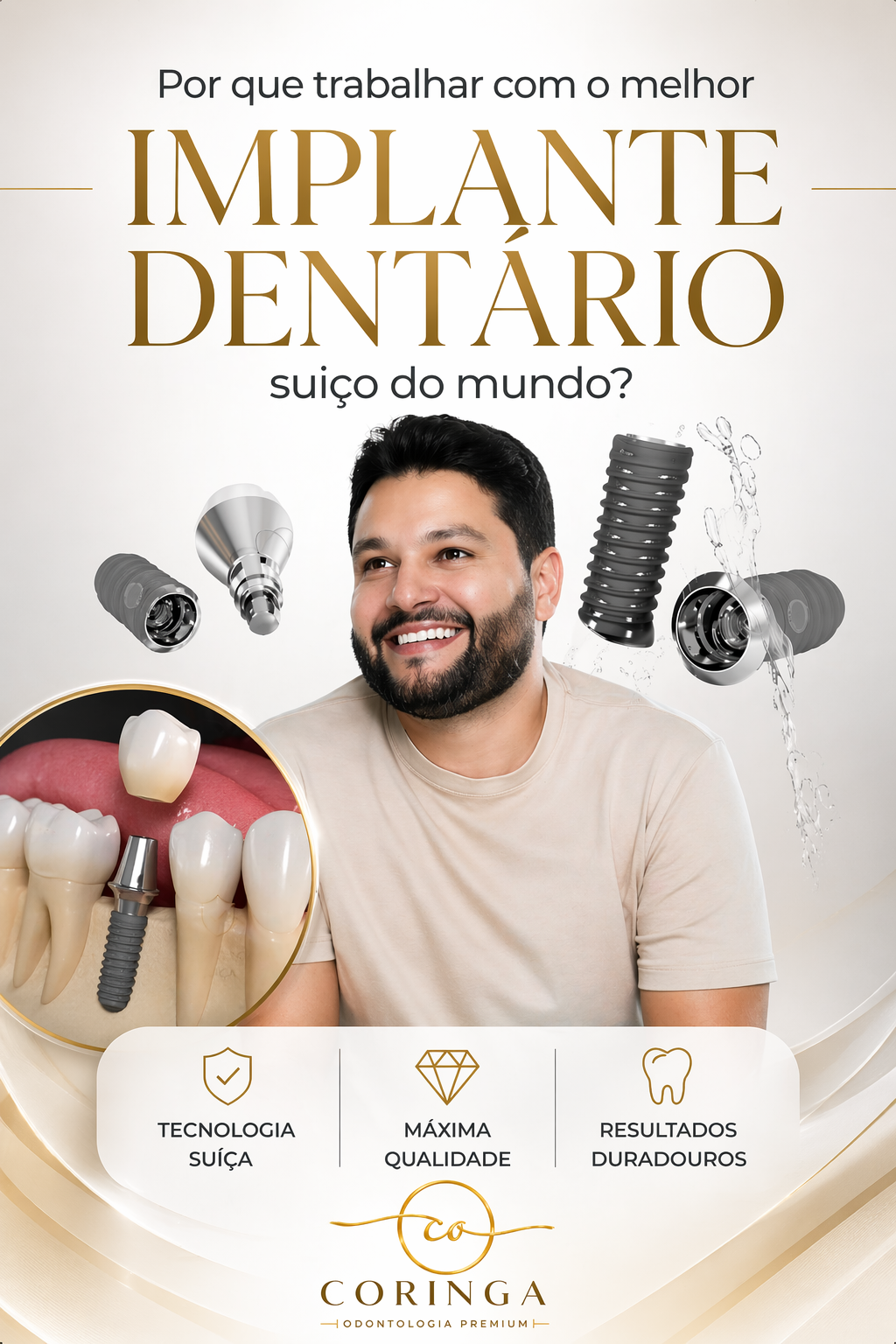 Implantes Dentários