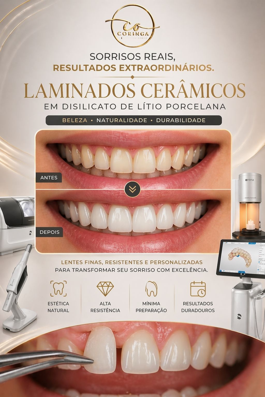 Lentes de Contato Dental em Porcelana